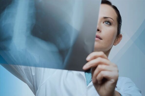 The radiography is a popular method for diagnosing cervical osteochondrosis.